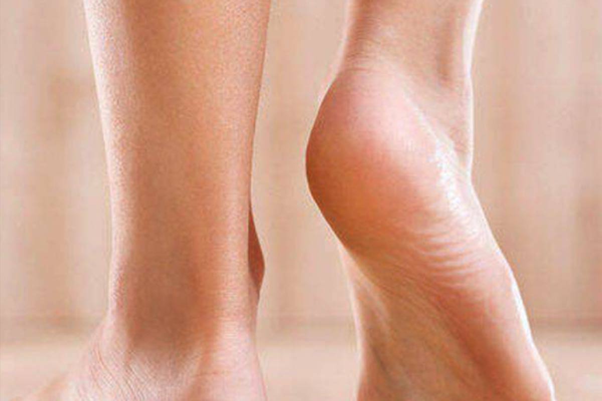 foot reconstruction